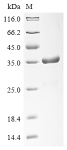 Human PIK3R2 Protein