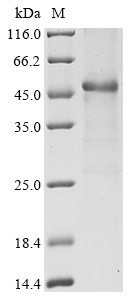 Human IL2RA Protein