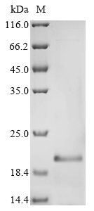 Human GFAP Protein
