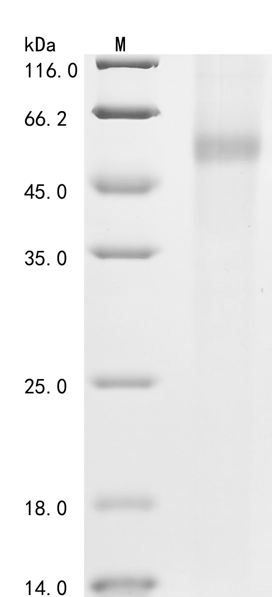 Human PARP1 Protein