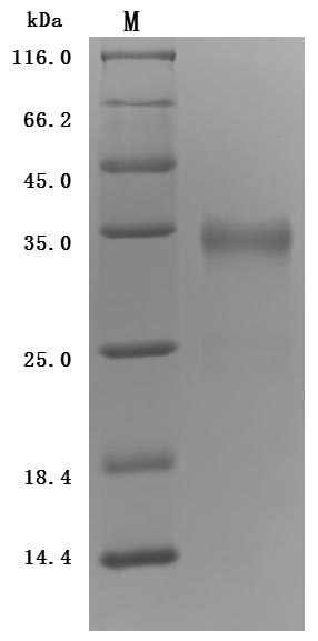 Human PRLR Protein