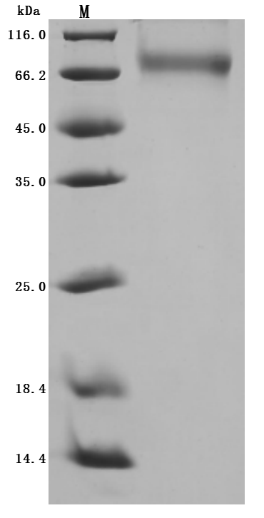 ANGPT2 Protein