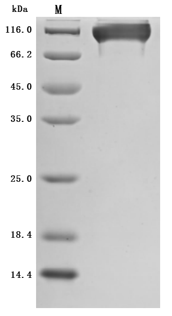 EGK_07847 Protein