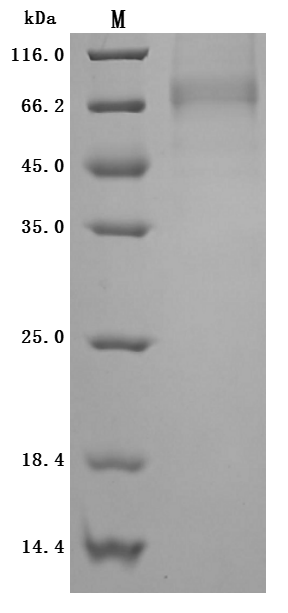 Human ANGPT2 Protein