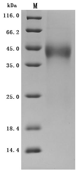 Human TFPI Protein