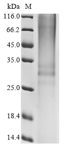 Human RNASE2 Protein