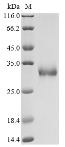Human EPOR Protein