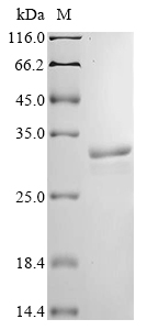 Clostridium acetobutylicum Acetoacetate decarboxylase Protein