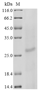Human IZUMO1R Protein