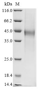 Newcastle disease virus Hemagglutinin-neuraminidase4 Protein