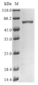 Human RPE65 Protein