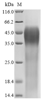 Human CATSPER1 Protein