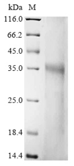 Human FNDC3B Protein
