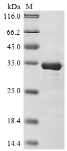 Human ZBTB32 Protein