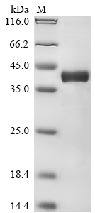 Mouse H2-D1 Protein