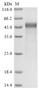 Newcastle disease virus Hemagglutinin-neuraminidase Protein