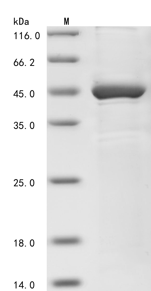 Human MBD2 Protein