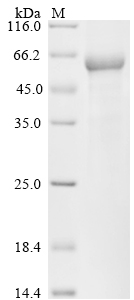 Human FTCD Protein