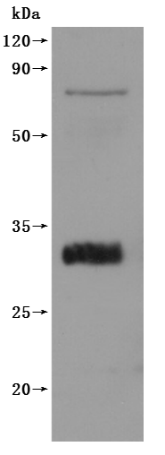 CLDN18-VLPs Protein