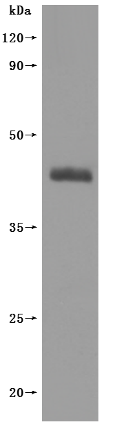 Human SSTR2-VLPs Protein