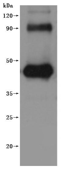 Human GPRC5D-VLPs Protein
