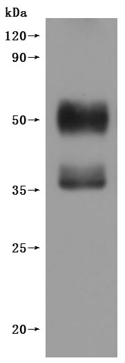 Human CXCR4-VLPs Protein
