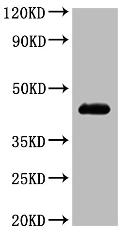 Human CCR4-VLPs Protein