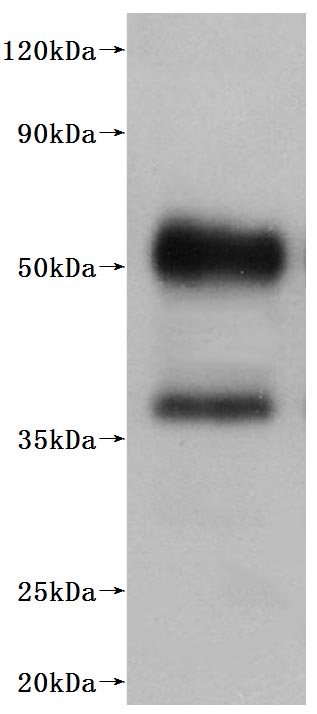 Human C5AR1-VLPs Protein