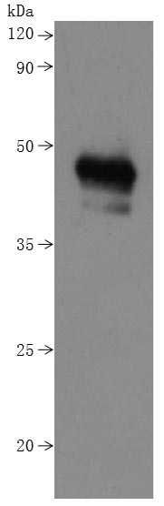 Human MS4A1-VLPs Protein