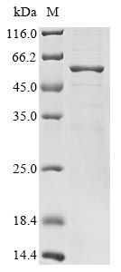 Bat coronavirus HKU3 Nucleoprotein2 Protein