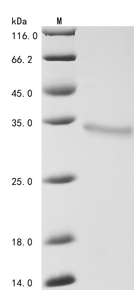 Human SPP1 Protein