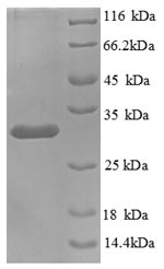 Human KNG1 Protein
