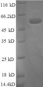 Human TFPI Protein