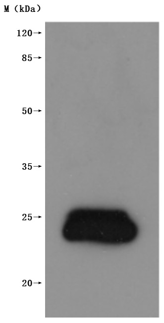 Recombinant Human Claudin-3 (CLDN3)-VLPs (Active)