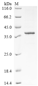 Recombinant Mouse Melanoma-associated antigen H1 (Mageh1)