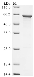 Recombinant Human O-phosphoseryl-tRNA (Sec) selenium transferase (SEPSECS)