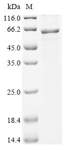 Recombinant Human Thioredoxin-interacting protein (TXNIP),Escherichia Coli