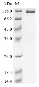 Recombinant Human Endogenous retrovirus group K member 6 Env polyprotein (ERVK-6), partial, Biotinylated