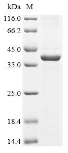 Recombinant Human Hyaluronan and proteoglycan link protein 1 (HAPLN1)