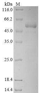 Recombinant Human Nuclear receptor subfamily 2 group F member 6 (NR2F6)