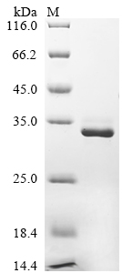 Recombinant Human Calbindin (CALB1)