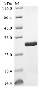 Recombinant Human Bcl-2-like protein 11 (BCL2L11)