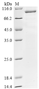 Recombinant Human Maltase-glucoamylase, intestinal (MGAM), partial