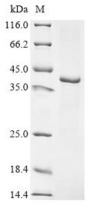 Recombinant Hepatitis B virus genotype A2 subtype adw2 Large envelope protein (S)