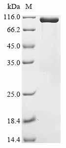 Recombinant Human Maltase-glucoamylase (MGAM), partial