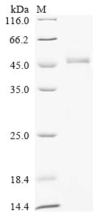Recombinant Human O-phosphoseryl-tRNA (Sec) selenium transferase (SEPSECS)