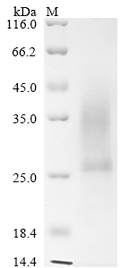 Recombinant Mouse Collagen triple helix repeat-containing protein 1 (Cthrc1)