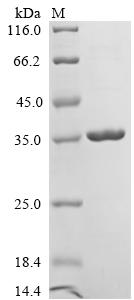Recombinant Human Odorant-binding protein 2a (OBP2A) (C114S,K127N)