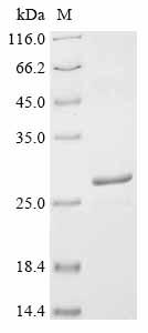 Recombinant Human metapneumovirus Fusion glycoprotein F0 (F), partial