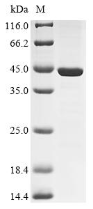 Recombinant Human Protein SSX1 (SSX1)